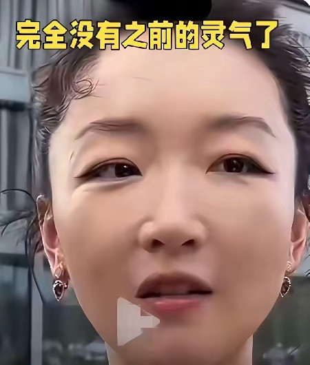 周冬雨的脸也肿了，看着非常的不自然。完全没有了当初的清纯模样，还是原生态脸好看顺