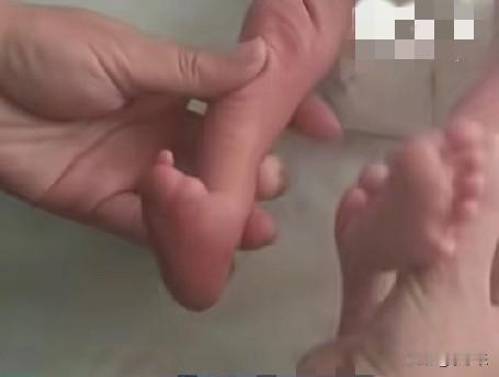 山东滨州的一对夫妻因女方输卵管问题，结婚后一直没有怀上孩子，后来做了试管婴儿，并