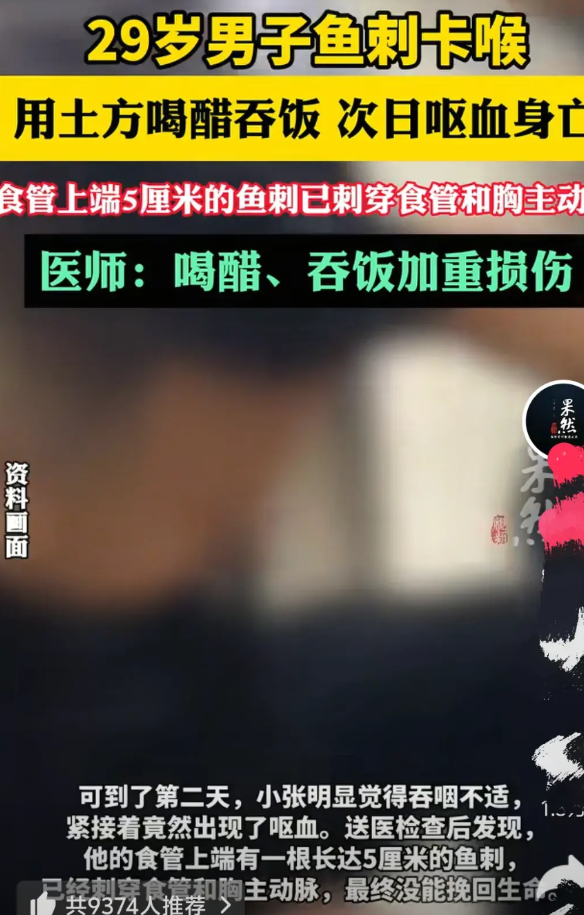 男子被鱼刺卡死了！河南，男子在吃红烧时，一根5cm长的鱼刺卡在脖子眼，他连喝两大