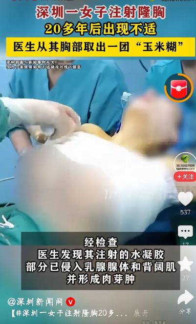 太吓人了，6月25号，深圳一个王女士，因为胸部持续不舒服去医院。结果一查，当年打