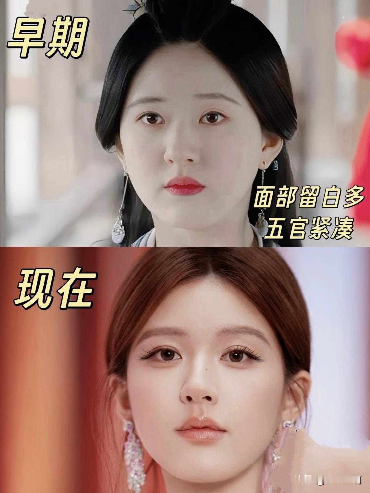 原来赵露思变了这么多。她一直坚持自己的鼻子是原生态。说实话我个人真分不出来。因为