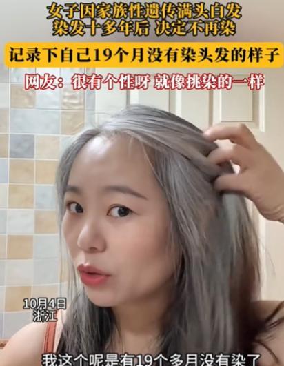 浙江一女子发现几根白发，她本以为拔了就是！万万没想到，仅仅几个月时间，她原本光亮