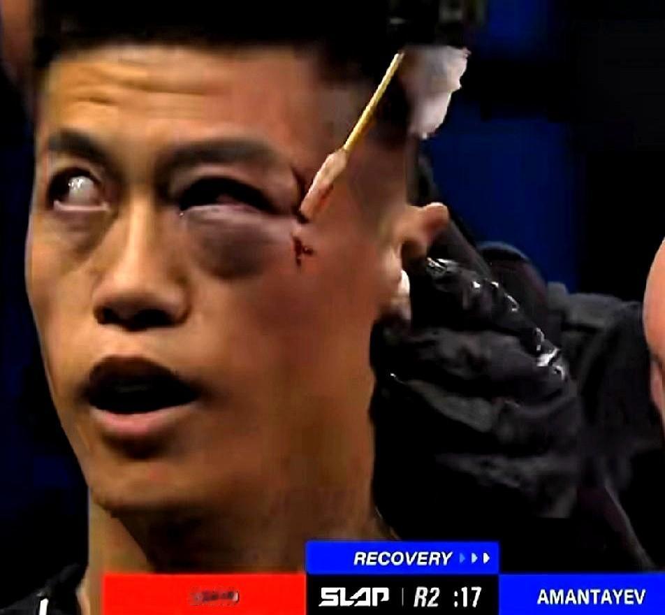 赵洪刚挨了三巴掌，没倒下，站起来了。不是他硬，是他没得选。通背拳练的是出手快