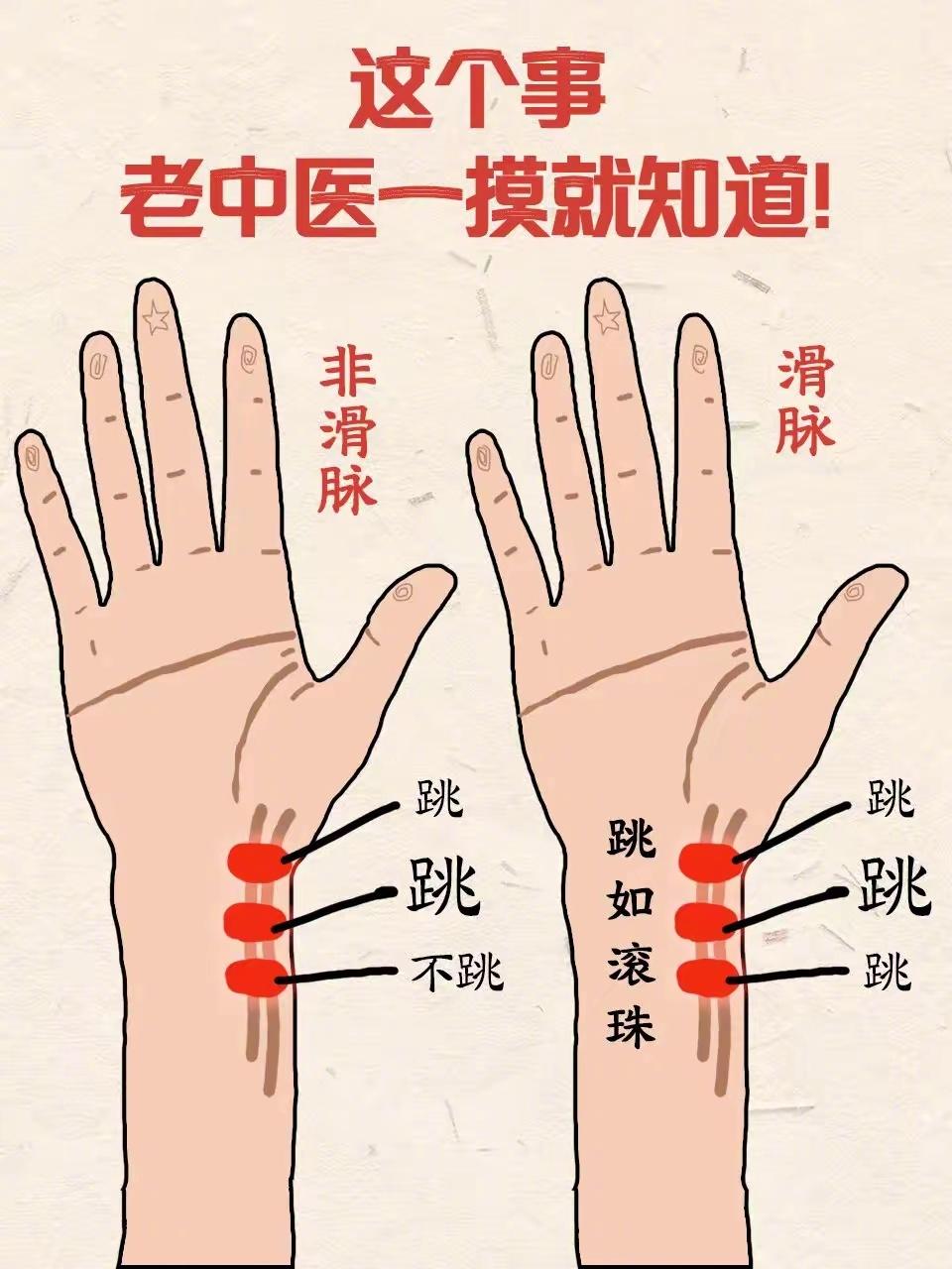 看到中医的这几张图震惊了！把脉不仅能把出喜脉，并且根据脉象还能判断出孩子是男孩还