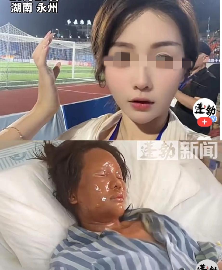 太骇人了！永州一美女竟因取快递惨遭毁容！永州有位周姓美女，在自家门口取快递时