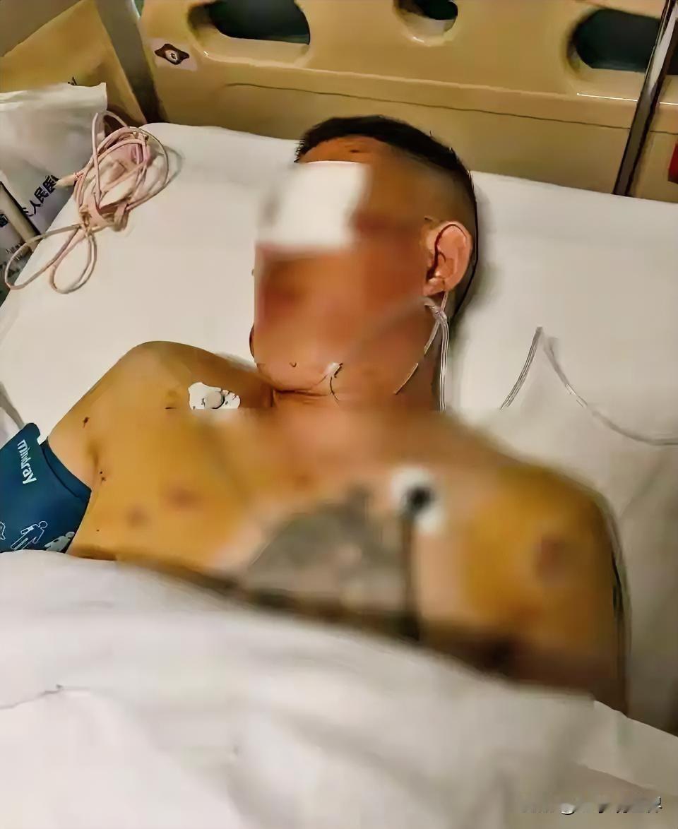 取170万遭枪击失明！歹徒自制4把火药枪蹲点一周，银行6分钟报警引全网怒怼1