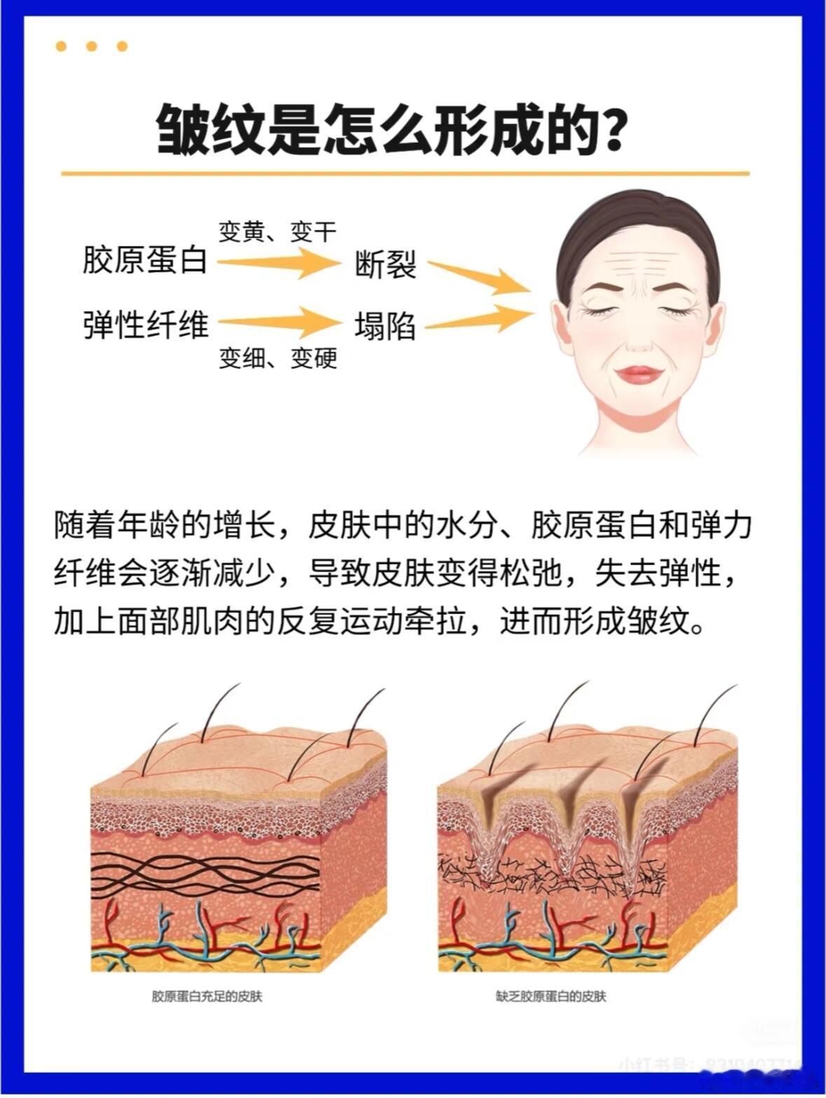 一起对抗衰老！阻止皱纹形成！皱纹的形成是皮肤老化的自然表现，主要受内在因素和外在