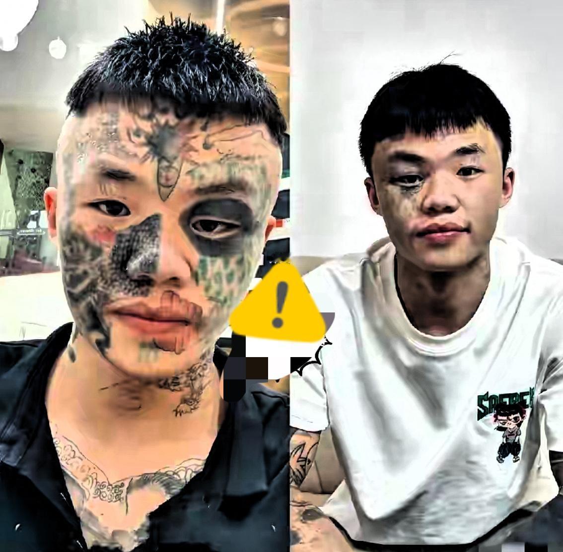“后悔了吧？”06年生的广东男孩夏朝勇，正咬着牙挨第五次激光洗纹身——三次下