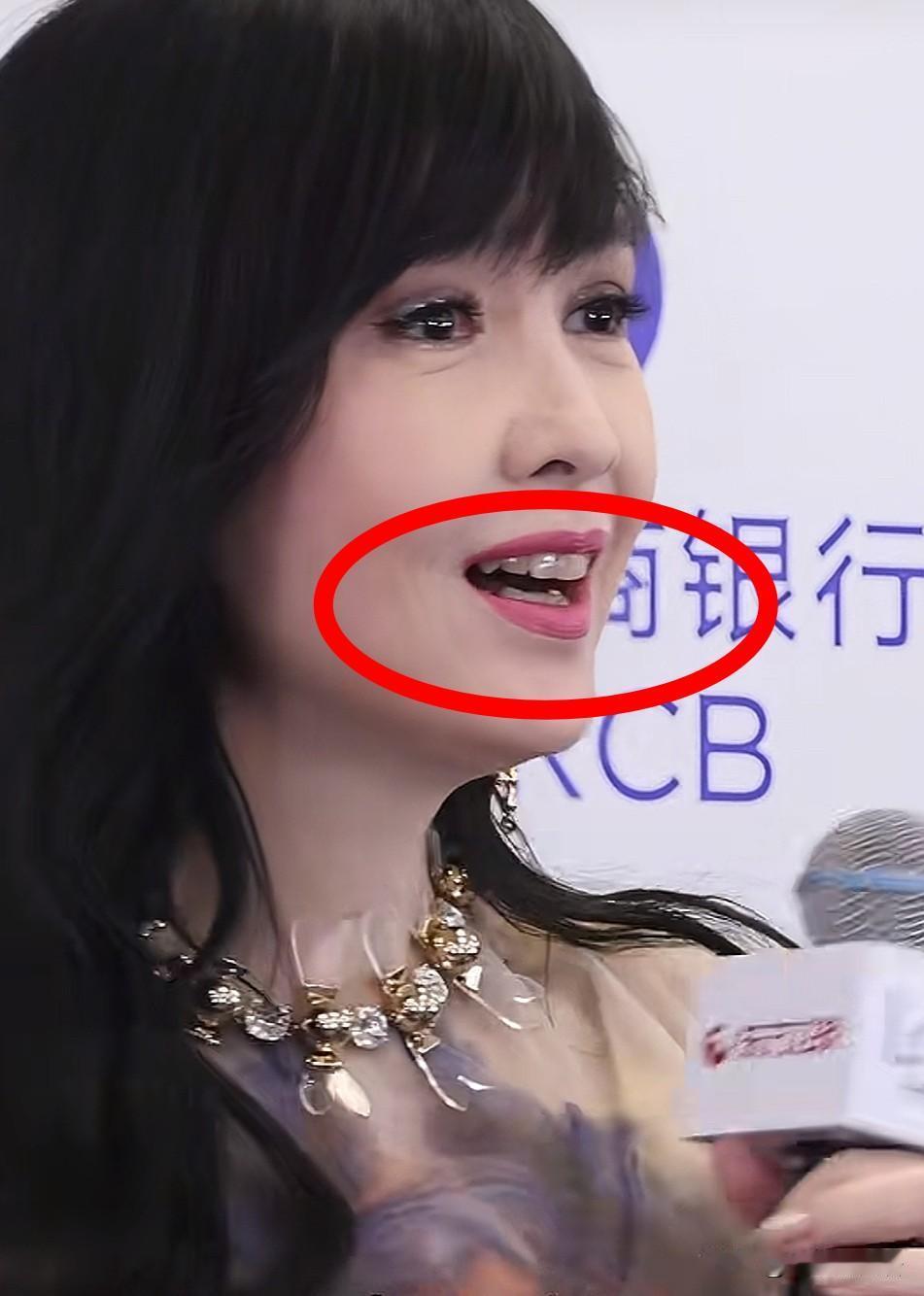 我的天第一眼我看到了什么毫不客气的说我还以为周慧敏戴牙套呢仔细一看原来她