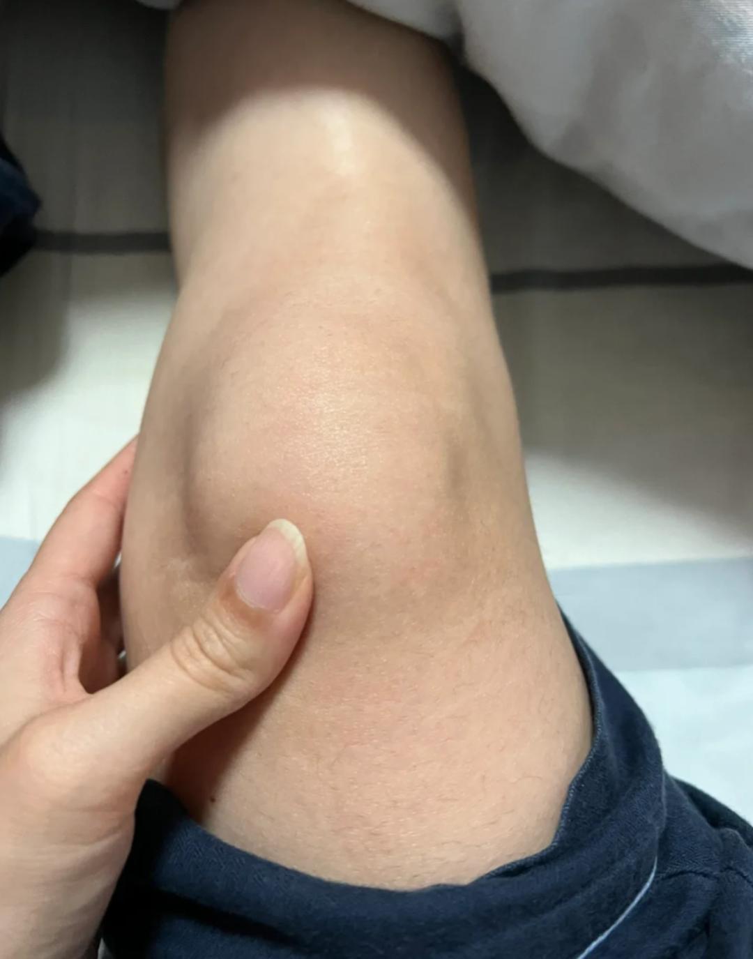 🌿膝盖健康小贴士｜膝关节骨炎的日常保养干货请收好✨有没有朋友一到变天膝盖就酸