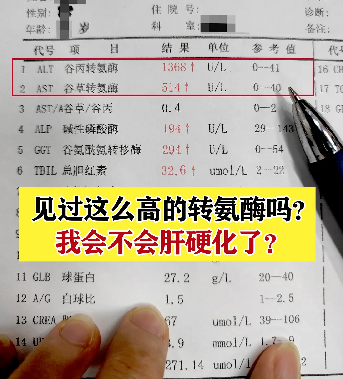 前段时间门诊接诊一位年轻乙肝患者，拿着化验单慌张询问：这么高的转氨酶吗...