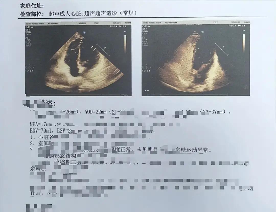 上周门诊，一位50岁女士拿着心脏彩超报告，盯着“心肌回声欠均匀”几个字，夜里睡不