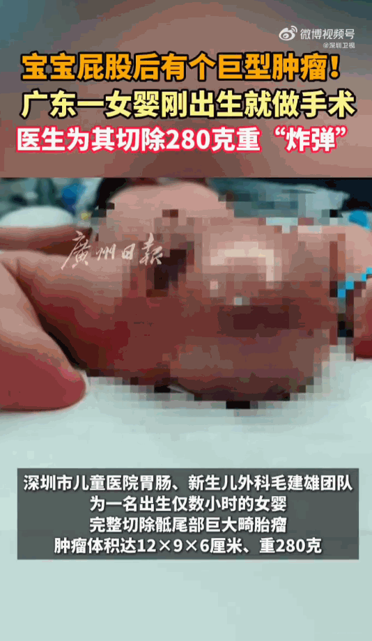 深圳的这个女婴出生后的第一场人生考验，不是学会吃奶，也不是适应外面的世界。而是在