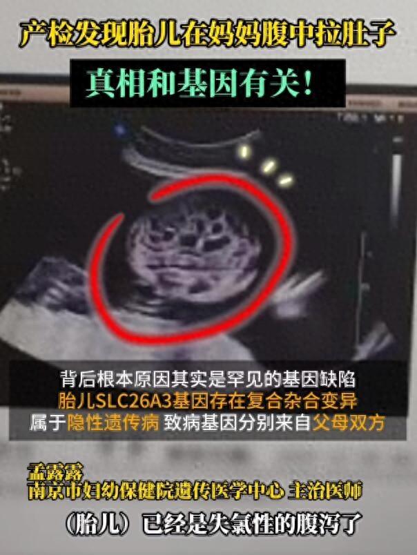 太罕见了！江苏南京，一位女子怀孕后一直都没有什么异常，以为肚子里的宝宝很正常，可