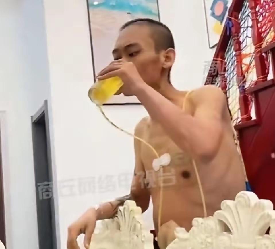 他拔掉管子，用最后的钱买了157罐啤酒。主治医生摇头说“没见过这样的”。但数