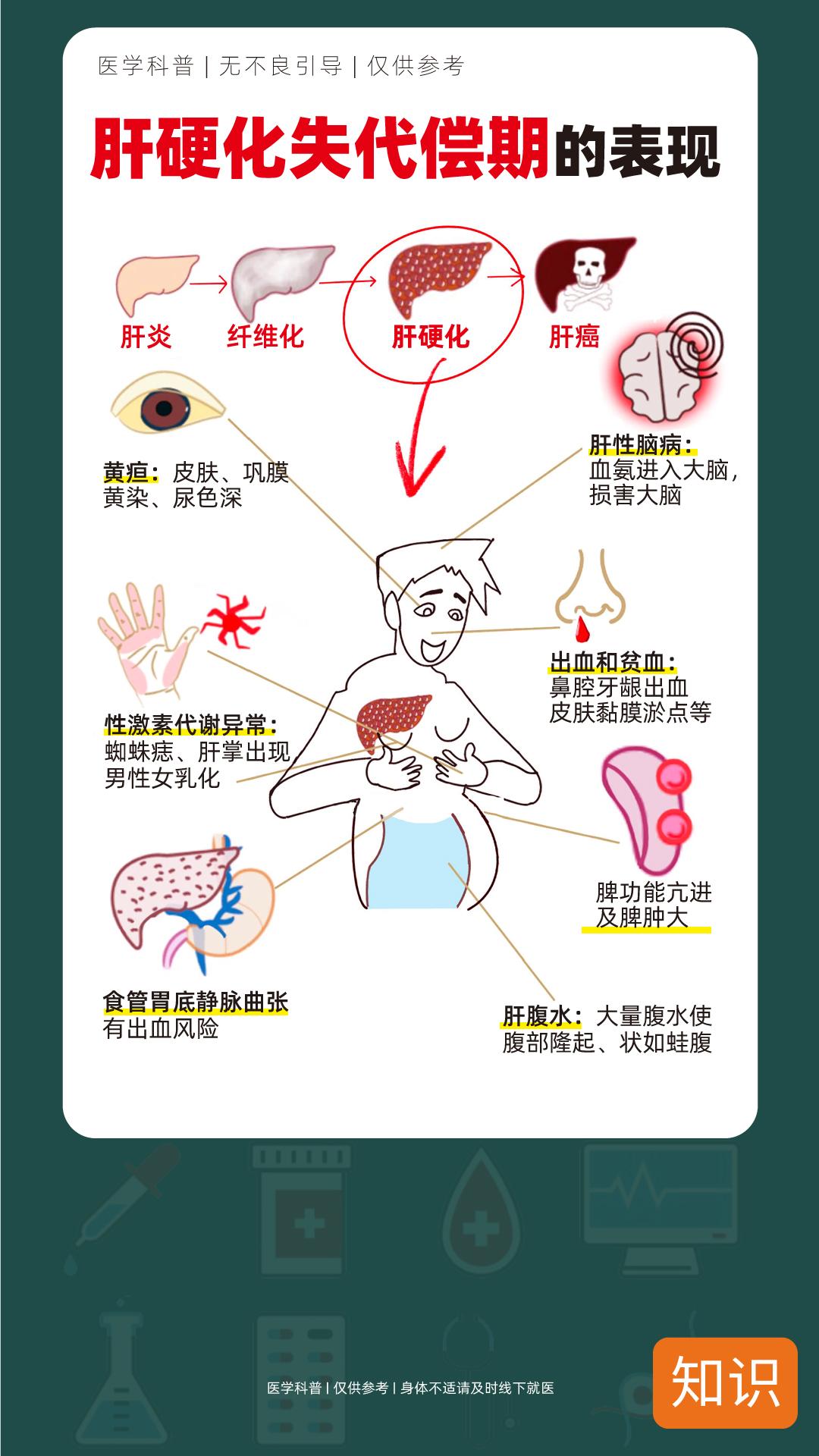 肝硬化失代偿期的表现，看看你有吗！