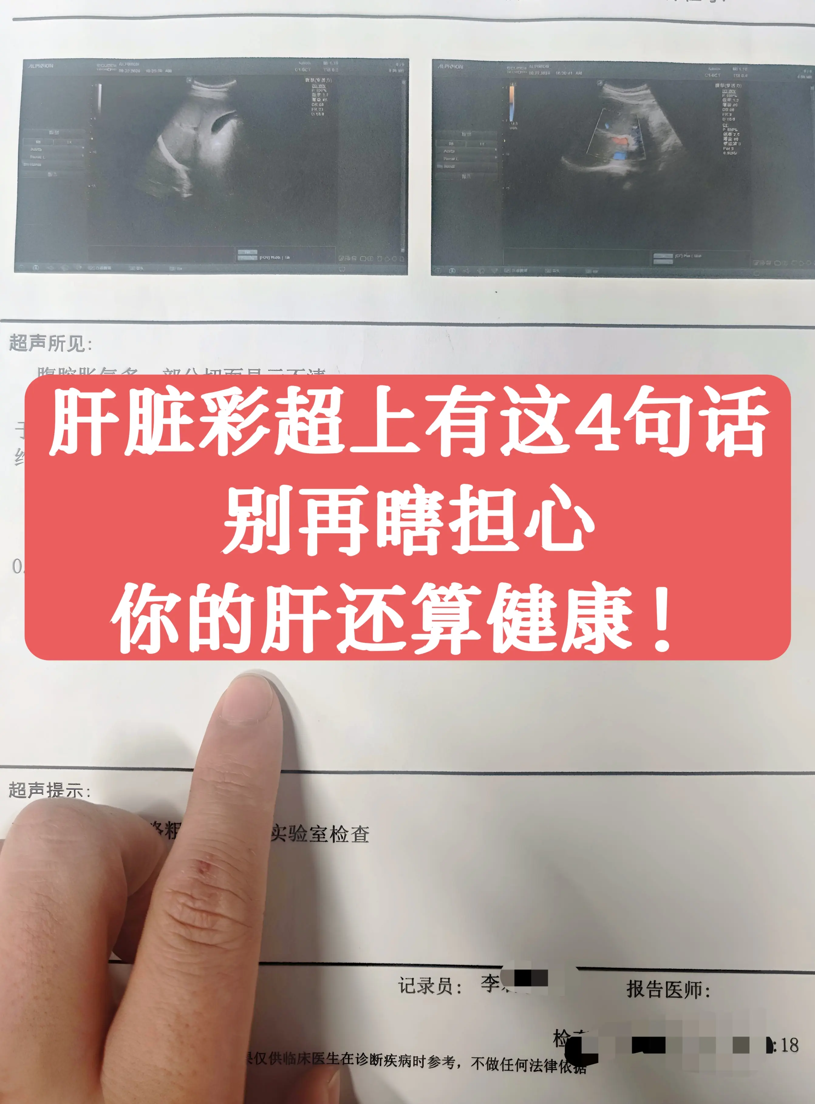 大家好，我是肝病科医生张峰，从医 30 余年，每天都要和各种肝脏彩超报...