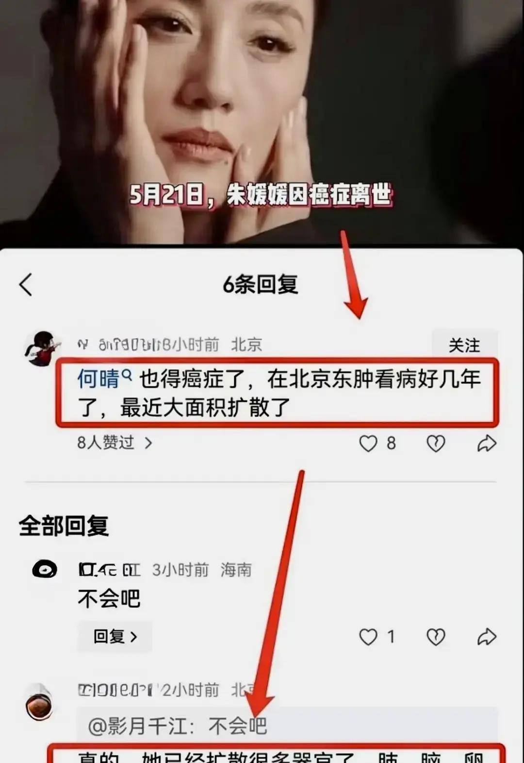 何晴活得好好的，别被“快不行了”的烂梗骗。2015年她动过脑瘤手术，现在该