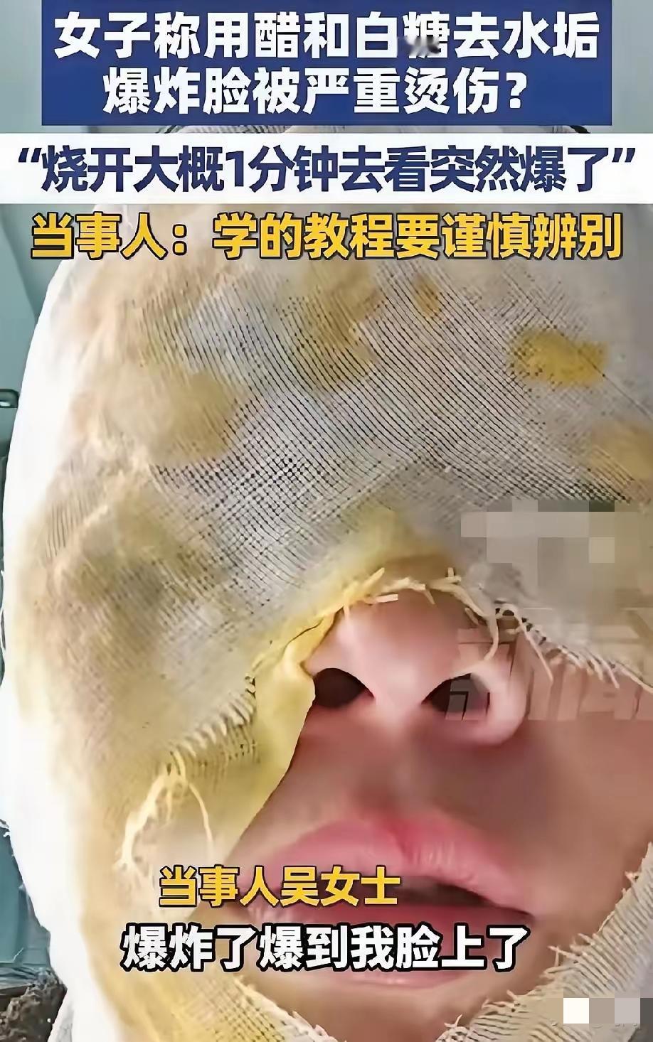 吓出冷汗！洗个水垢竟被炸伤，这些“网红教程”真要人命！河北大姐信了网上