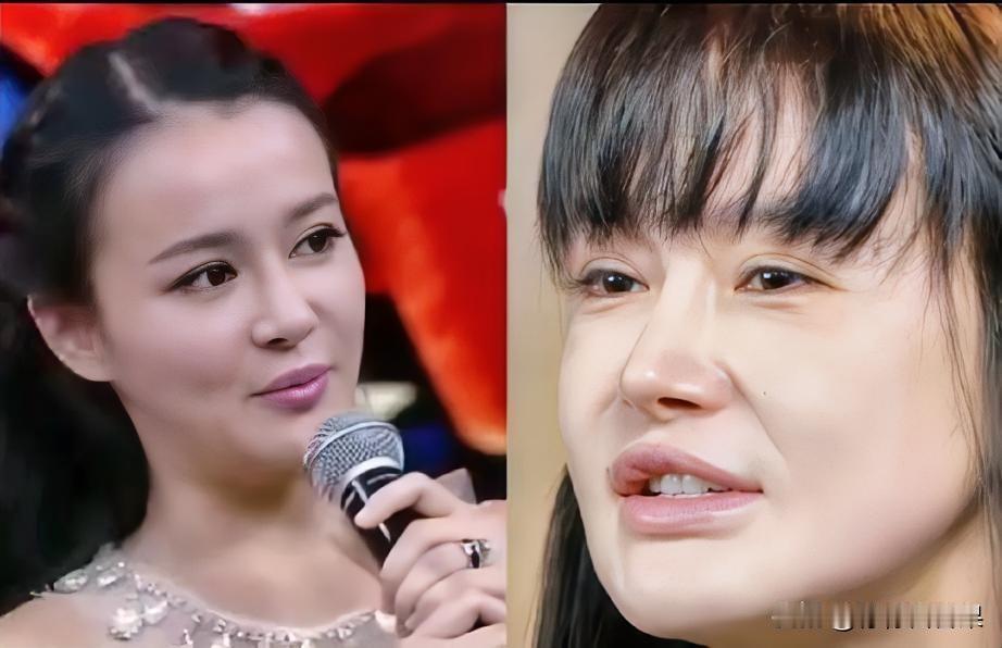 真心劝大家三思而后行，医美整容真不是一劳永逸。看看冉莹颖前后对比，变化太让人感慨
