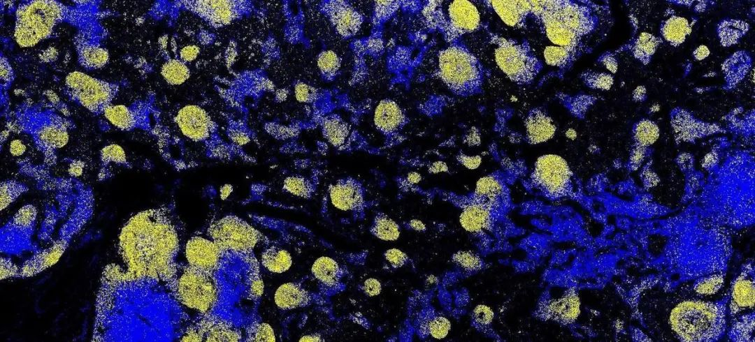 新华网: 抗衰老研究新成果一我国科学家发现肿瘤免疫逃逸新机制