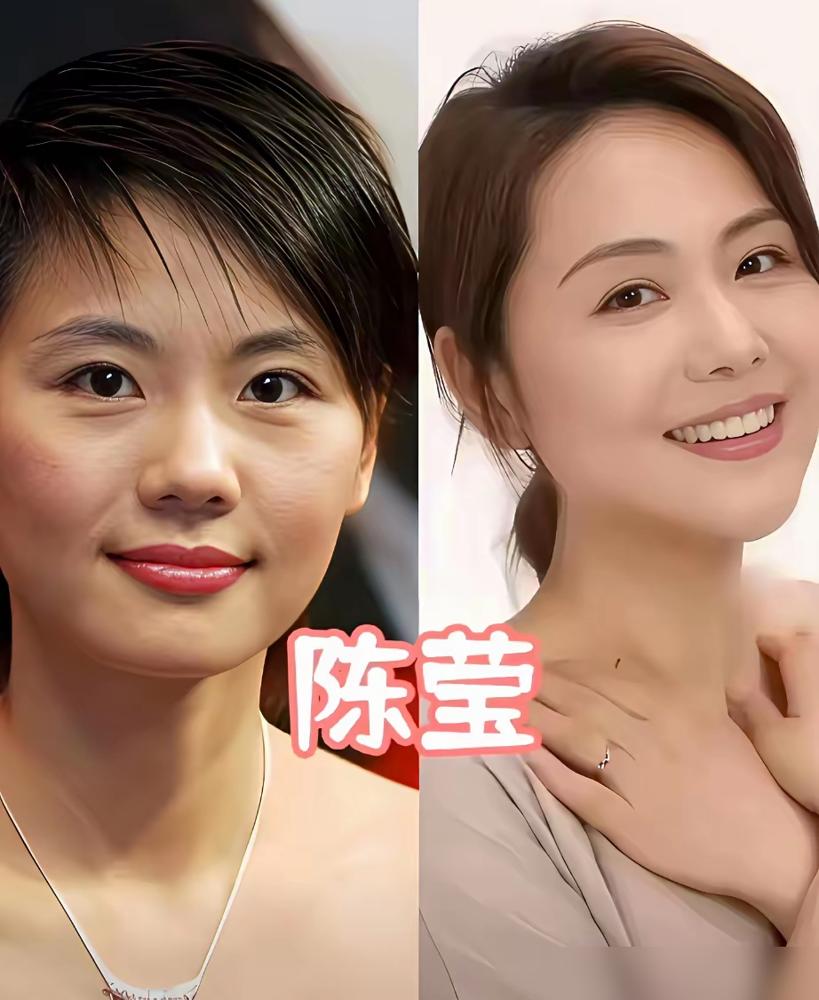 别被林心如那张温婉的脸骗了，如果她当年没赶在进组前把那口参差不齐的烂牙拔了，紫薇