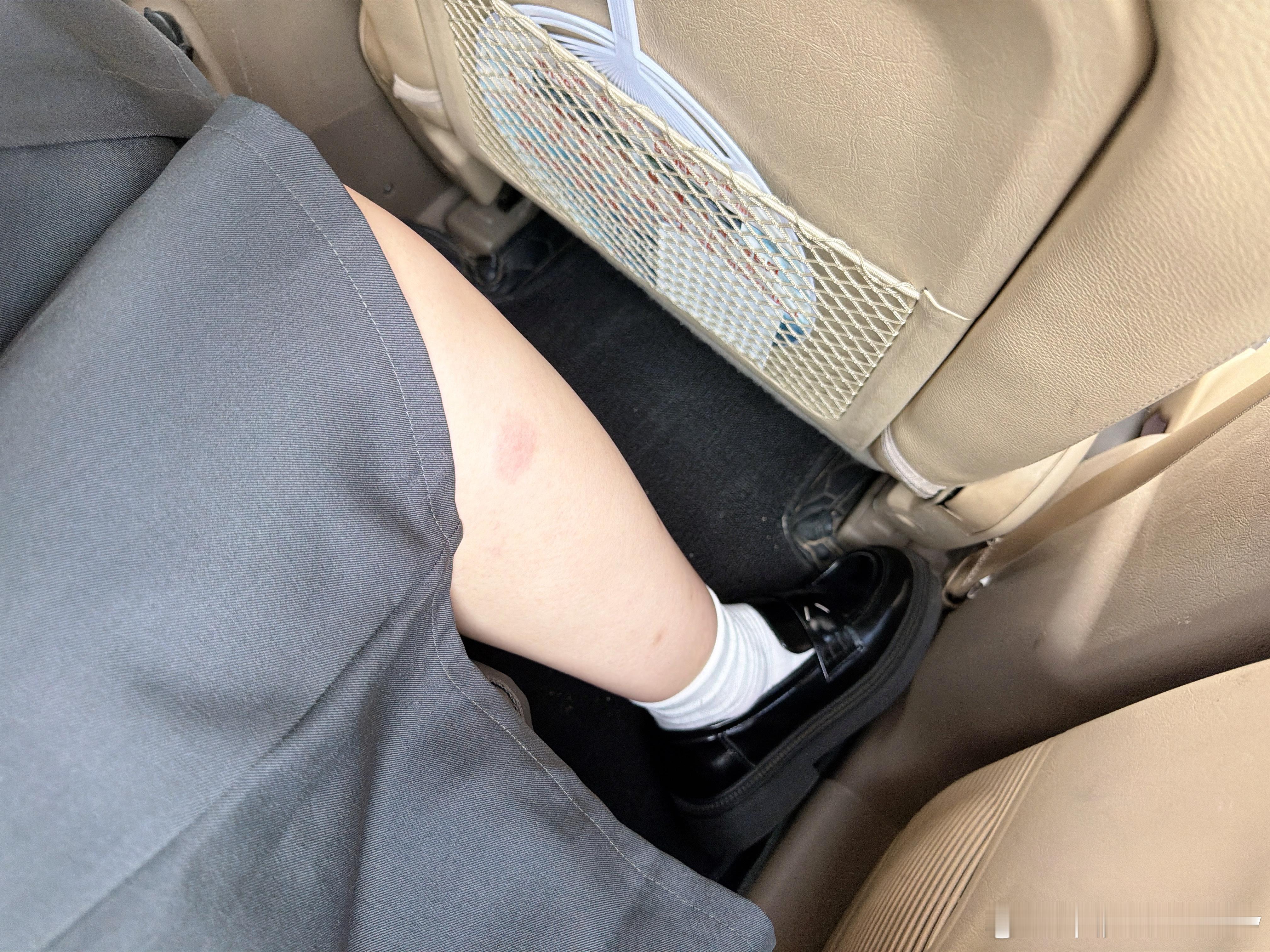 蚊子真的坚持不到夏天结束了吗