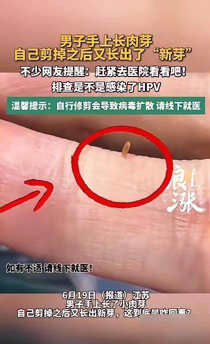 悲剧还是发生了！这种事真不是个例，我前阵子脖子上长了个小肉粒，嫌去医院麻烦自