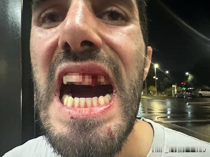 出门在外要低调，否则不会有人惯着你，一名名叫：尤瓦尔·谢克尔的以色列预备役军人，