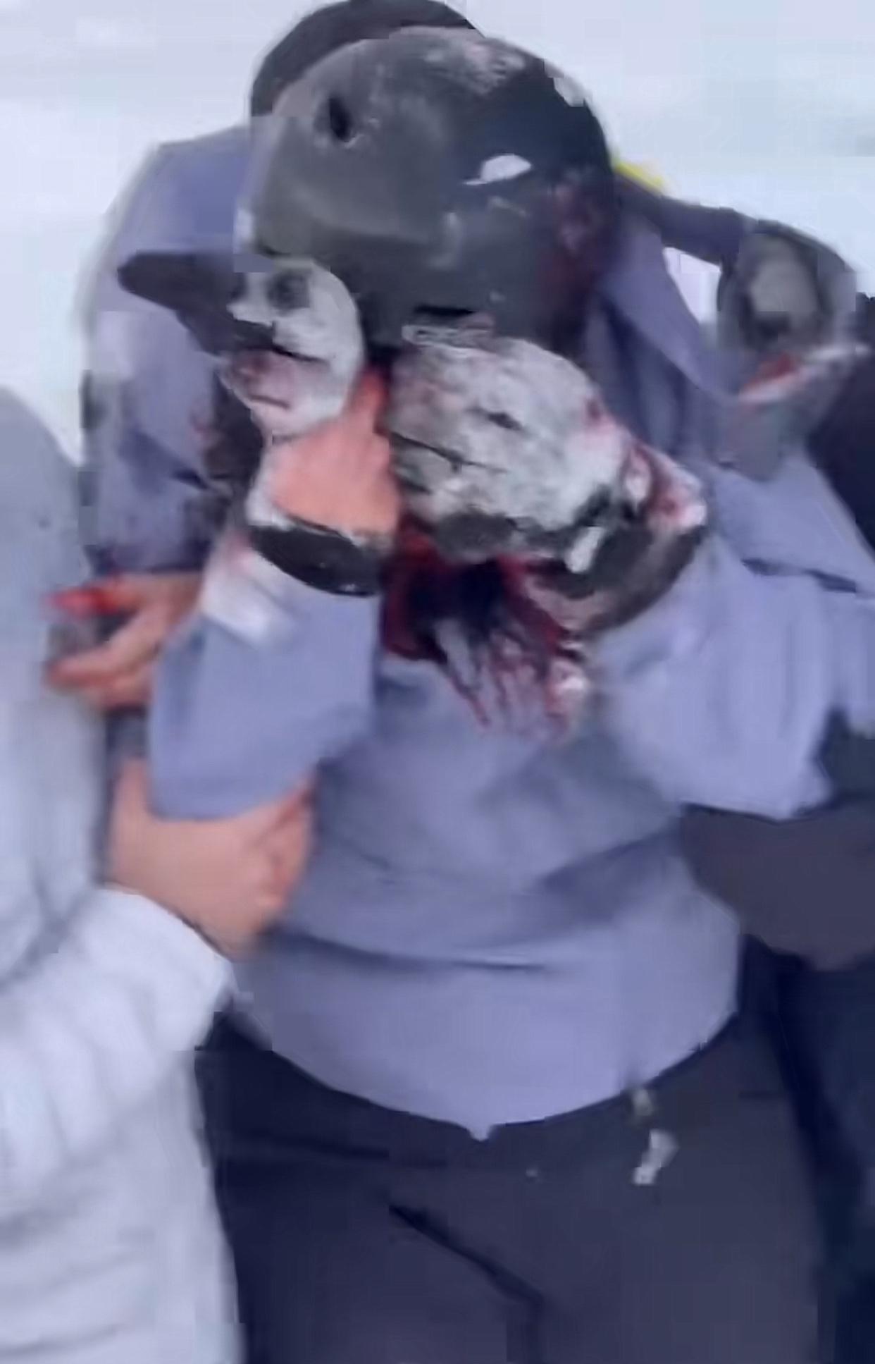 长长心吧！一点安全意识都没有！以为雪豹是家猫啊！无视劝阻靠近拍照！脸被咬的血淋淋