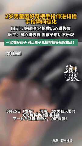 太痛心了！河南一个2岁的小男孩，趁大人没注意，把手指头塞进了排插的插孔里。就那么