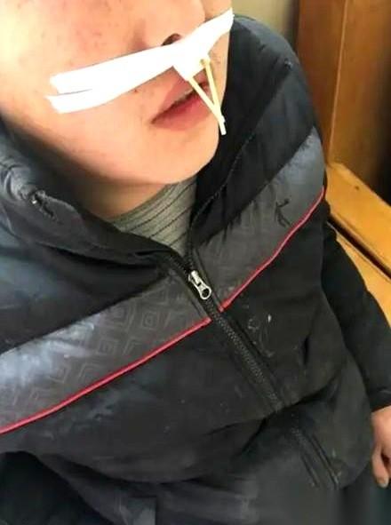 我跟你说个事儿，挺扎心的。很多小孩，因为鼻炎，长期张着嘴睡觉，你知道最后怎么着