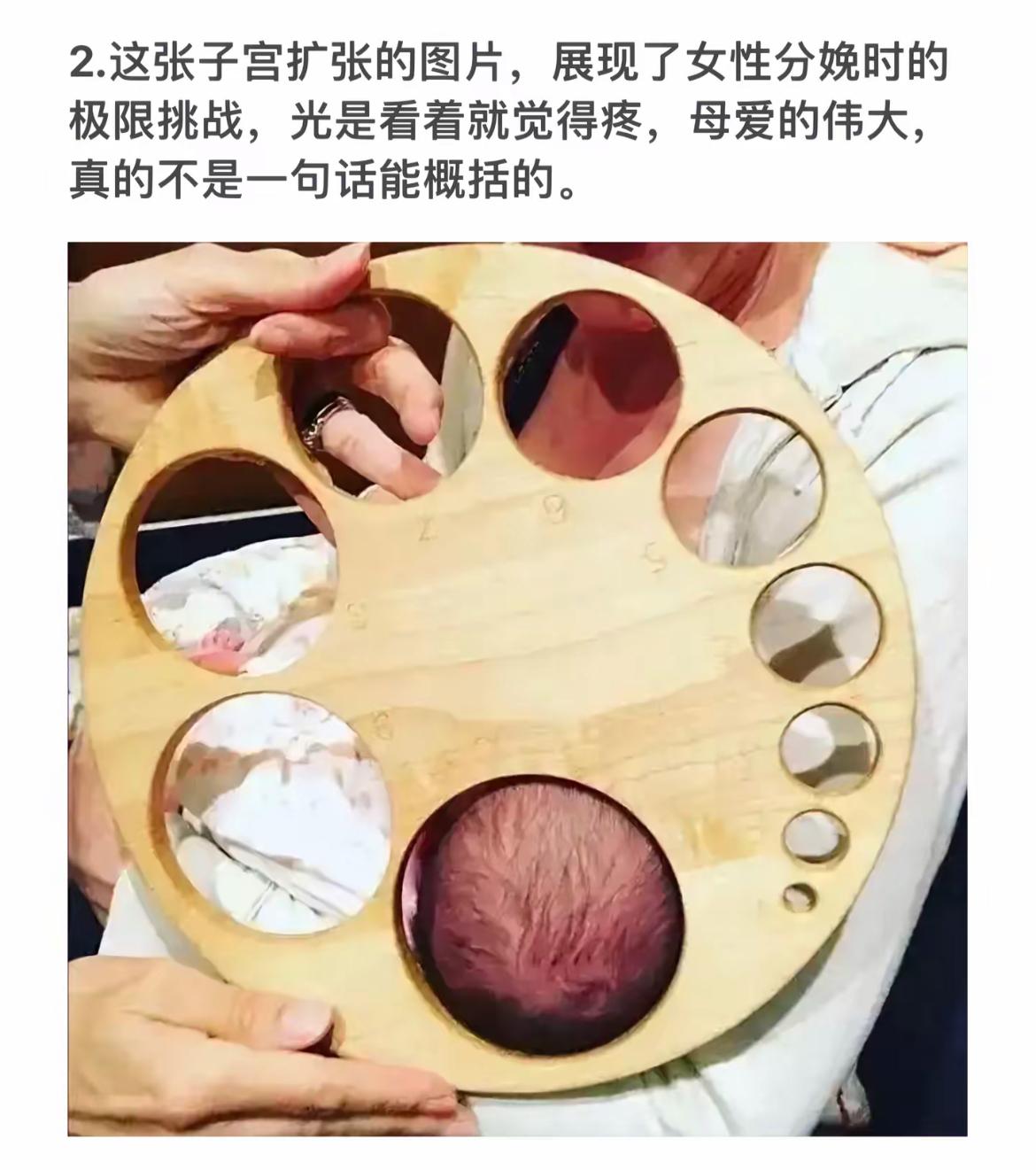 见证子宫扩张的奇迹，母爱的伟大无法言喻！💕👩‍❤️‍👩