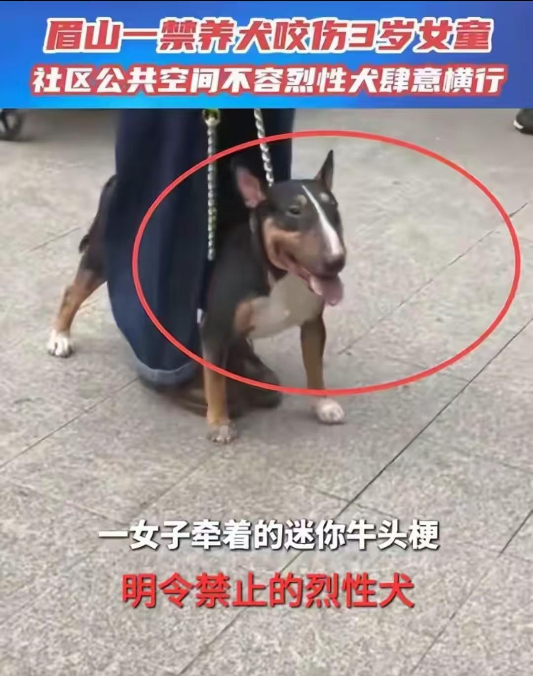 恶犬连咬伤几人后，狗主人才拿铁链拴住它，还用双腿紧紧夹住狗，其实狗主人是知道要给