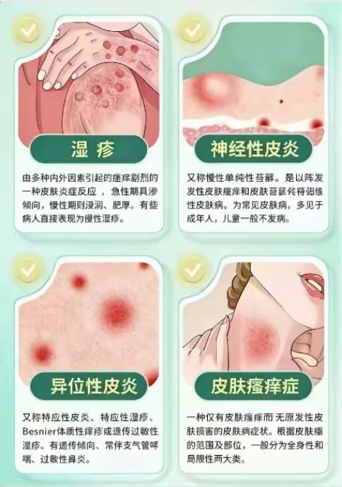 皮肤病的轻重从来和外观无关AI看皮肤病准确率到底有多高皮肤痒得睡不好、反复脱皮还