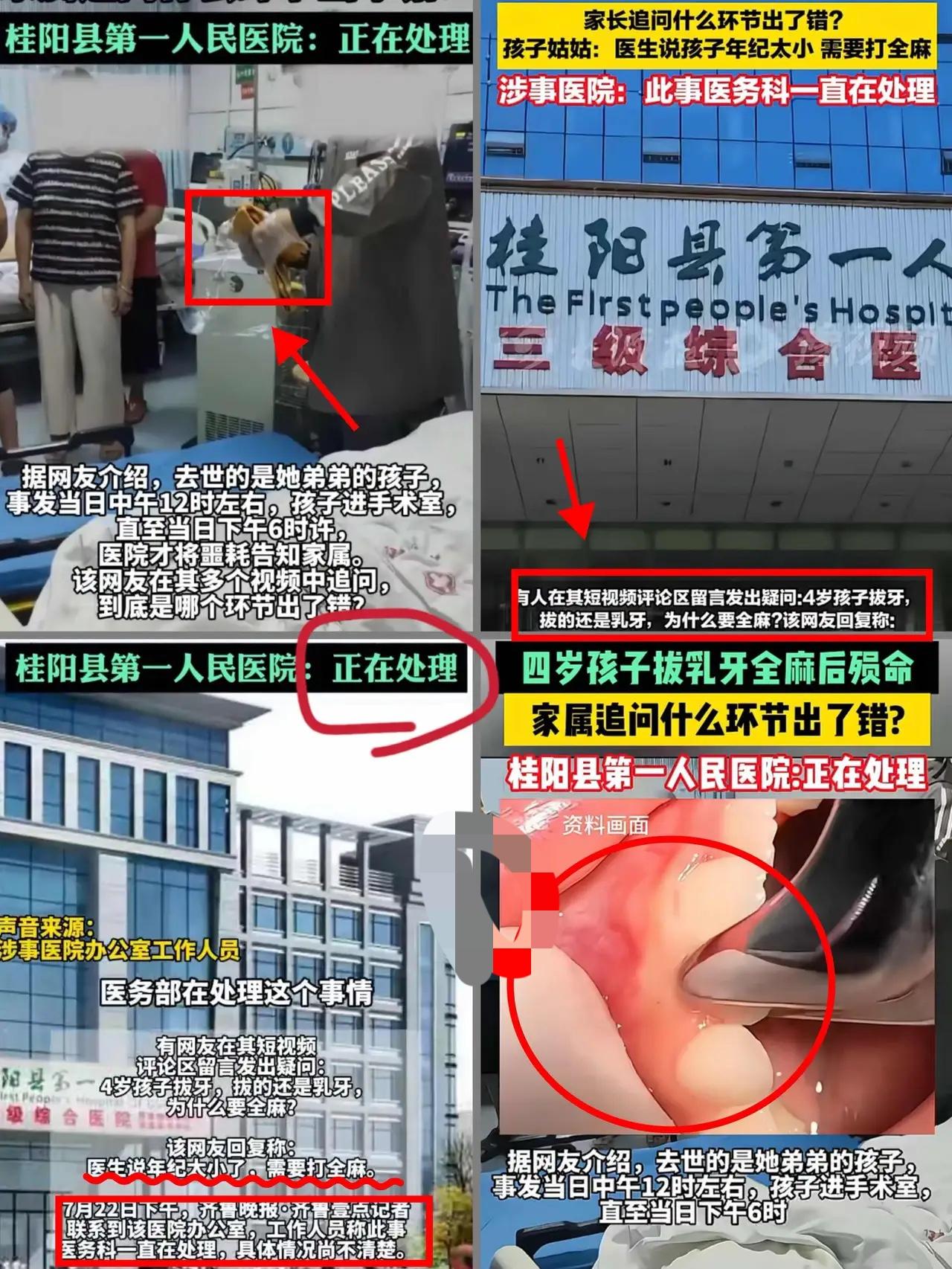 一觉醒来，桂阳第一人民医院天塌了！4岁娃拔颗乳牙，全麻后再也没醒过来，这到底是