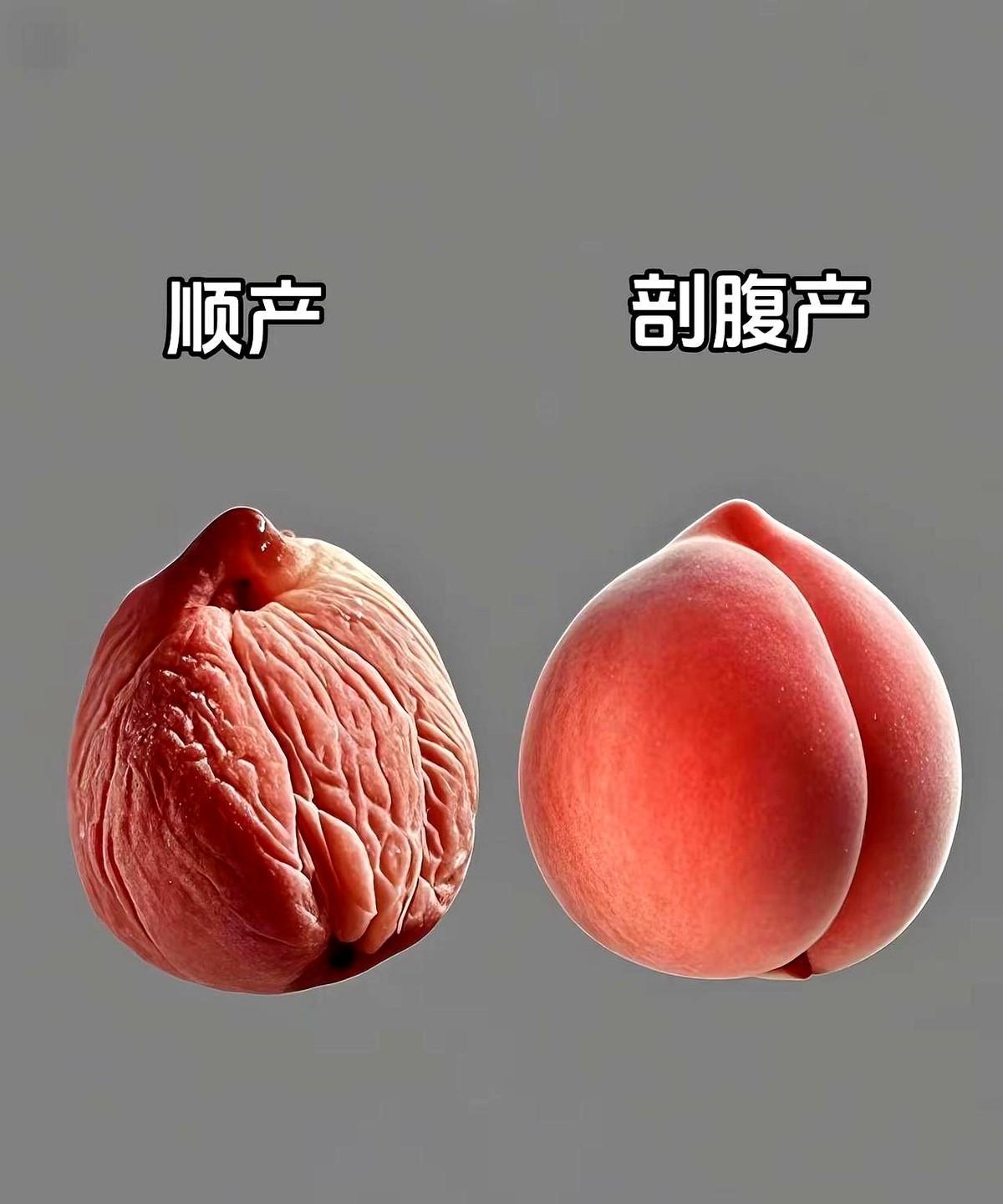 终于知道医生为啥都劝能顺就顺！你觉得是剖腹好还是顺的好呢？那天跟产科闺蜜唠嗑，