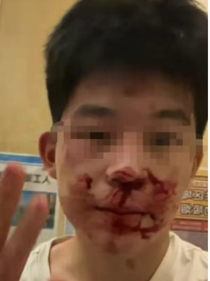 冒充民警打人者拘12天，借高考名义提前释放，22万买受害者闭嘴！民警子女就能肆意