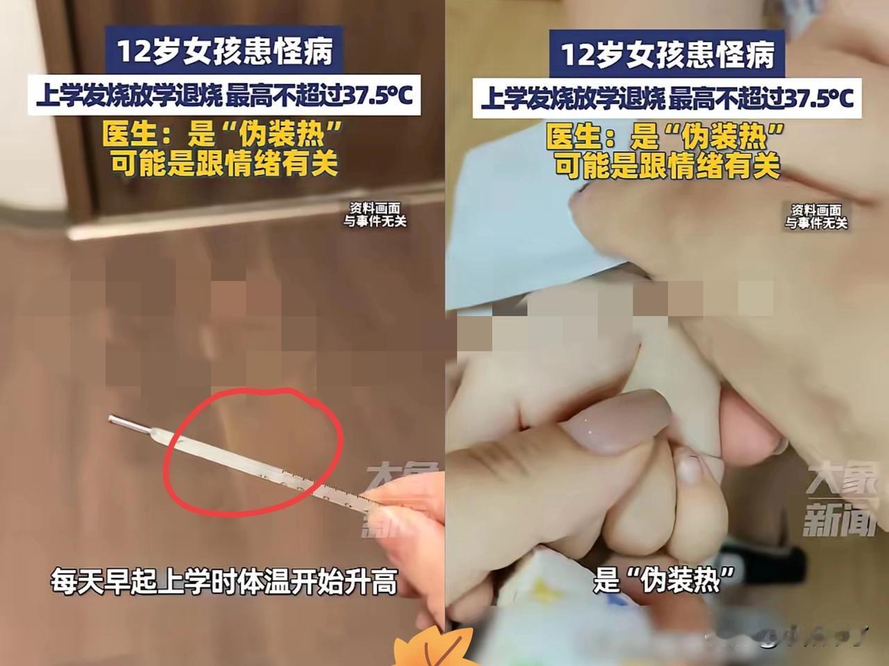 “开眼界了！”近日，河南，一女孩在一年时间内反复低烧，体温总在37.1℃到37