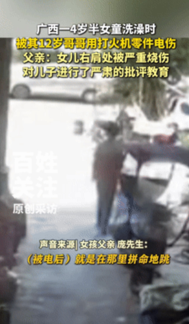 细思极恐！广西钦州，一4岁半女孩在洗澡时，被哥哥用打火机零件电伤，导致女孩右肩严