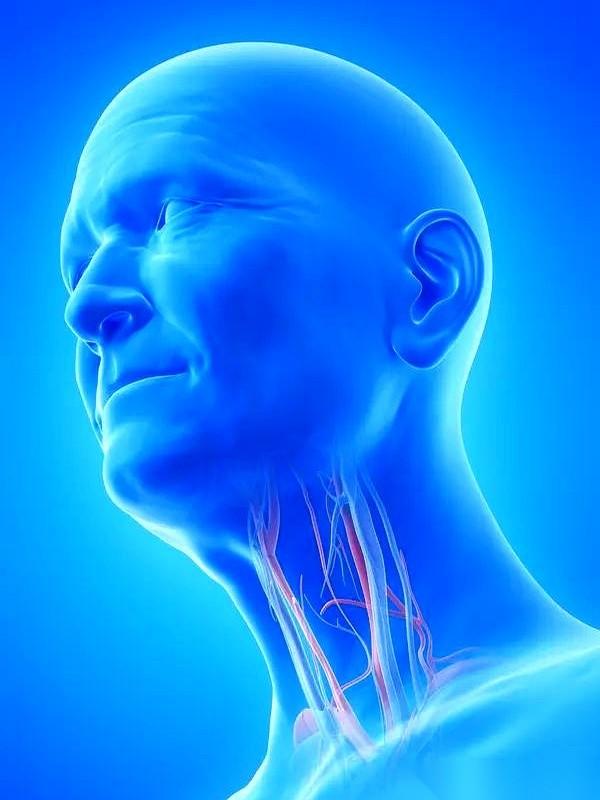 说出来不怕你笑话，去年体检查出颈动脉有斑块的时候，我真慌了。0.21厘米。听