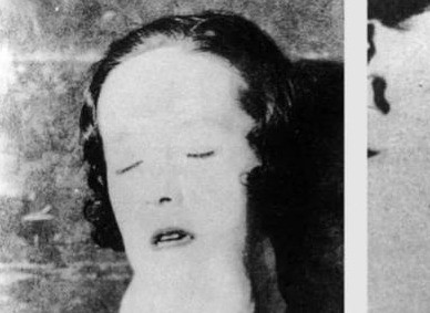 镭毒入骨：少女殒命的真相你敢相信吗？一个年轻女孩，仅仅因