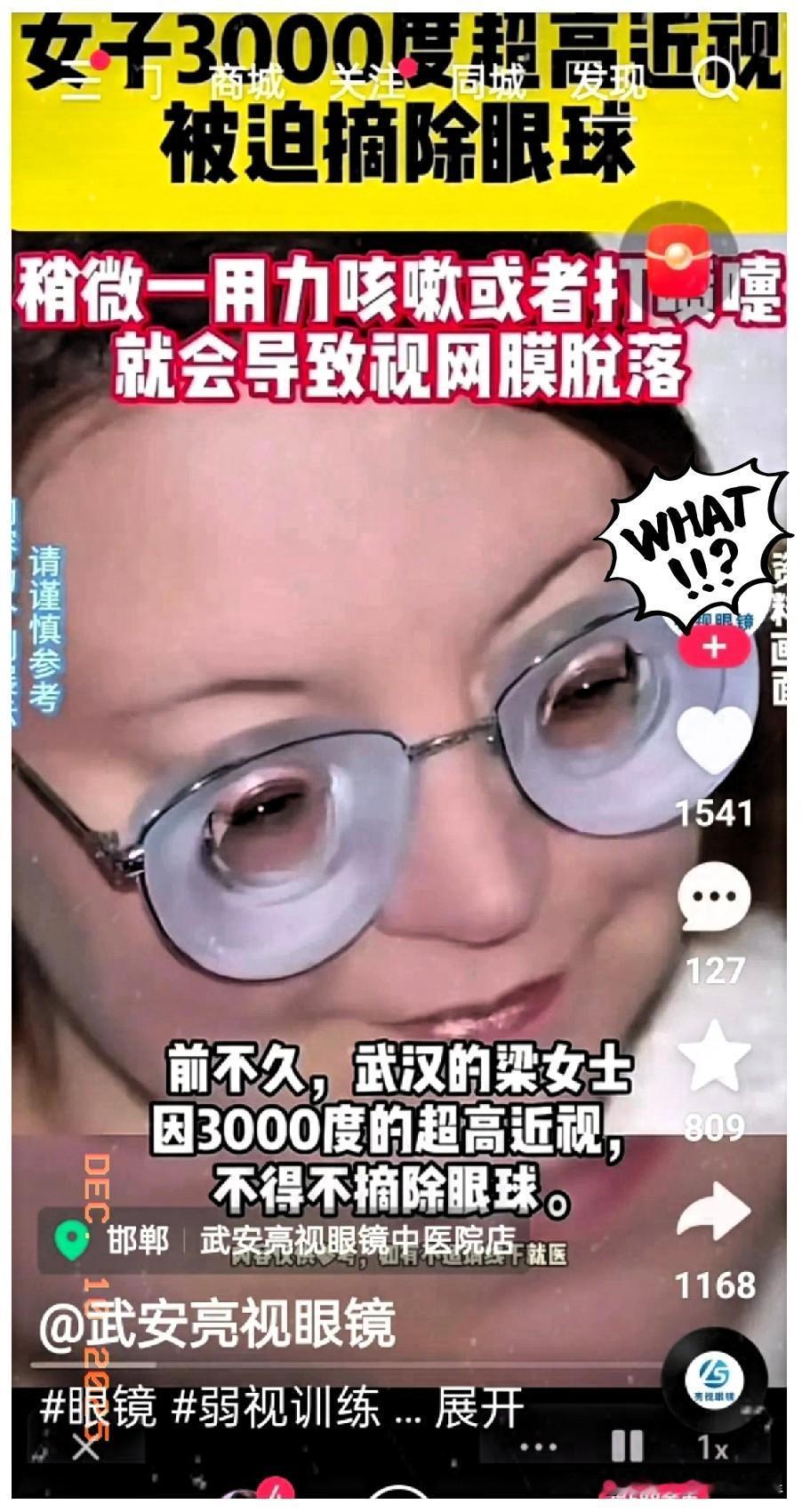 就因为3000°的高度近视，不得不把眼球摘除。这不是恐怖片，这是前不久武汉一位梁