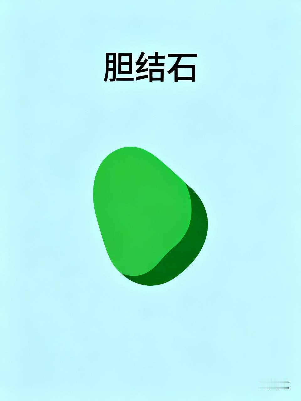 胆里长了“小石头”？这个中成药专攻肝胆淤堵，给胆来一次大扫除体检查出胆结石，