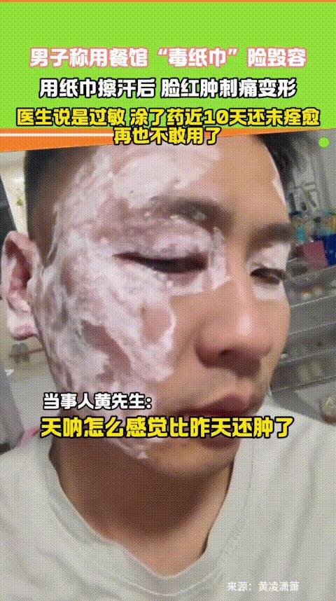 “太吓人了！”安徽，一小伙去吃麻辣烫，期间被热的流了一头的汗，就用店里的纸巾擦了