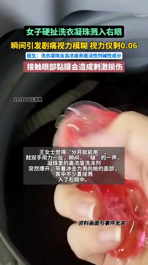 “悲剧还是发生了！”近日，浙江杭州，一女子洗衣服时，发现洗衣凝珠黏在了一起，她用