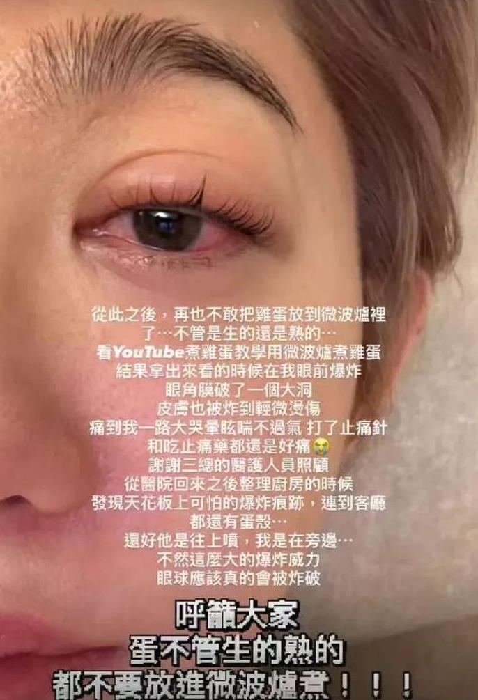 台湾女演员王晴发文说，自己用微波炉煮鸡蛋，没想到一打开微波炉鸡蛋就炸开了，自己的