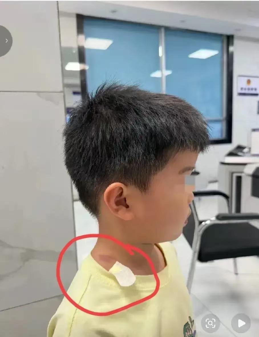 长沙“摸臀事件”已经传到国外去了！我一个在国外生活多年的朋友说的很直白：“这女的