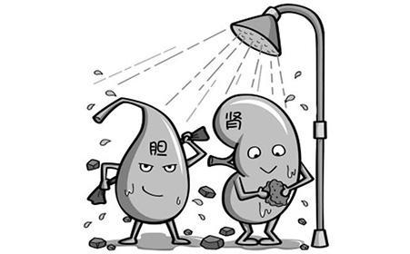 只要结石存在, 就要坚决清除它, 先从日常饮食开始