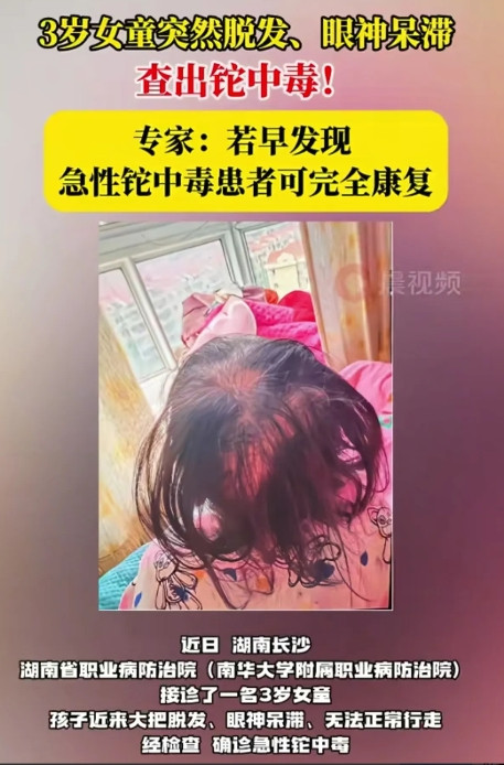 好好的一个人，怎么会铊中毒呢？近日，湖南长沙，一名3岁女童因频繁出现大